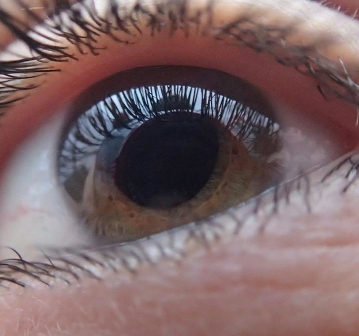 Badanie oczu na najwyższym światowym poziomie.